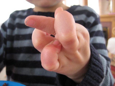 Child with Hyper mobile fingers